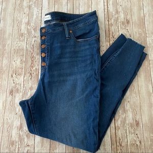 Madewell 9" Mid-Rise Skinny Jeans Button-Front